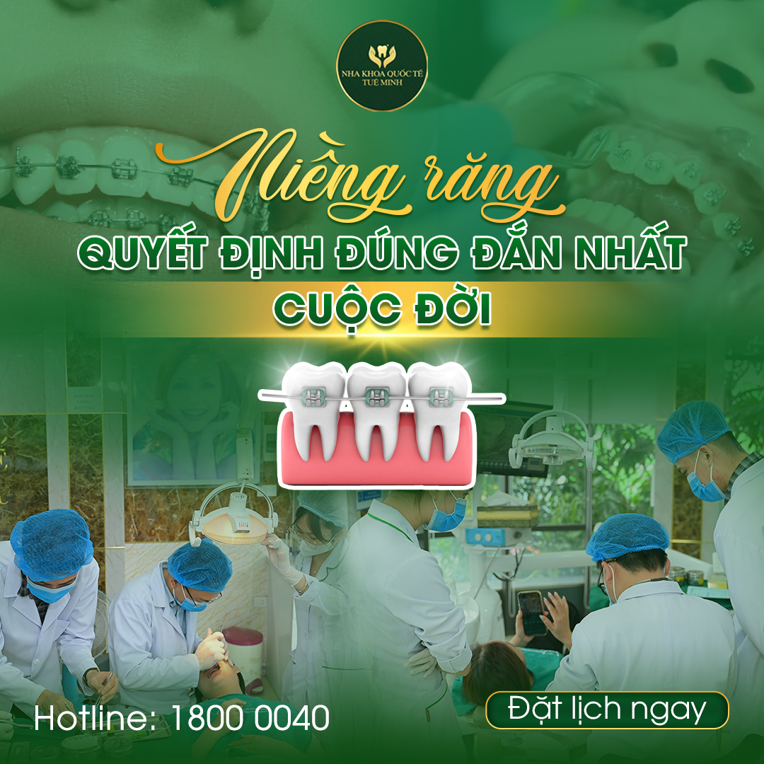 Niềng Răng – Quyết Định Đúng Đắn Nhất Cho Nụ Cười Lý Tưởng