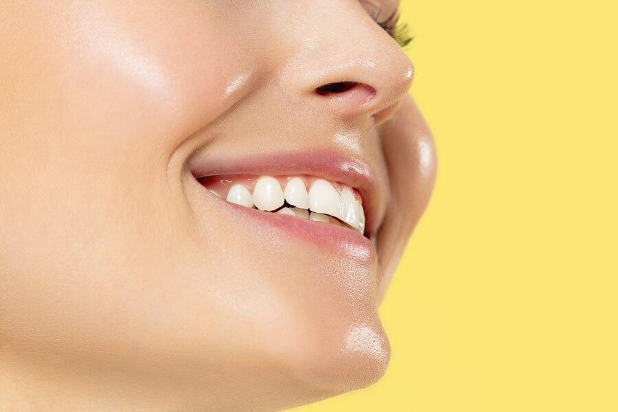 Khám Phá Phương Pháp Bọc Sứ Tại Nha Khoa TUỆ MINH