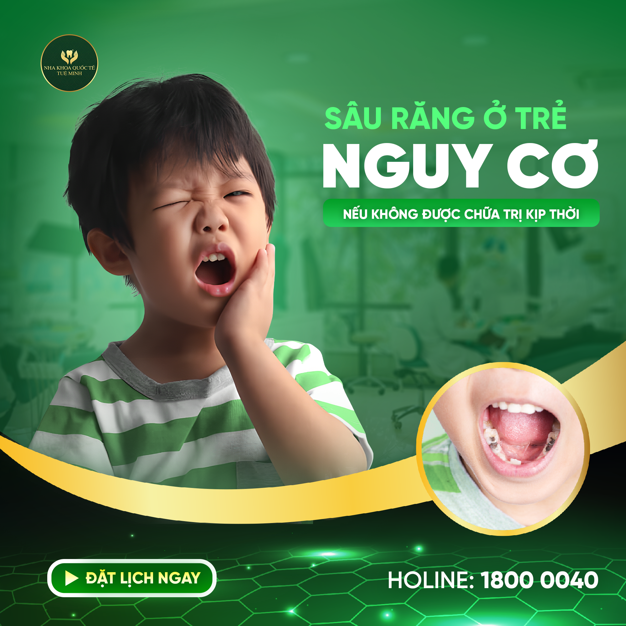 Sâu Răng Ở Trẻ – Nguy Cơ Tiềm Ẩn 