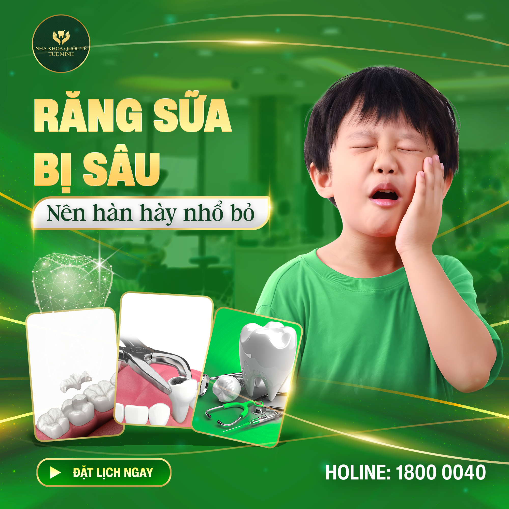 ĐỪNG ĐỂ SÂU RĂNG ÁM ẢNH CON BẠN!