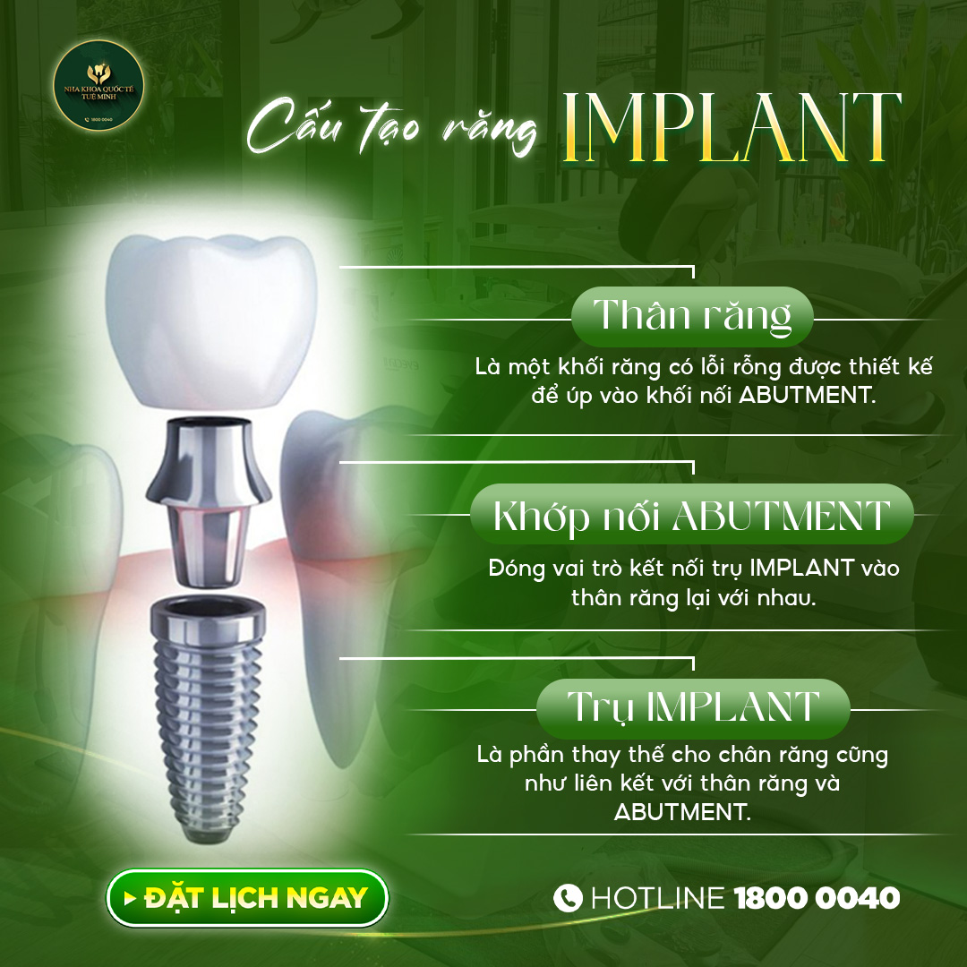 ĐAU ĐỚN VÌ MẤT RĂNG? TRỒNG IMPLANT NGAY